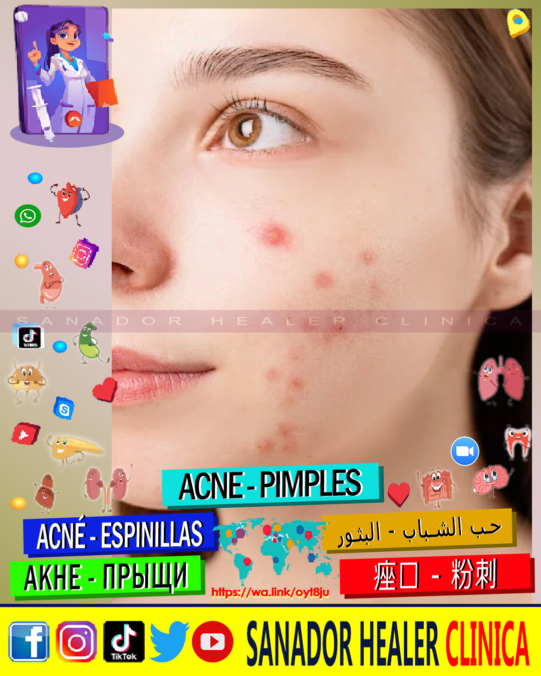 Sanador healer Clinica - Acne Pimples